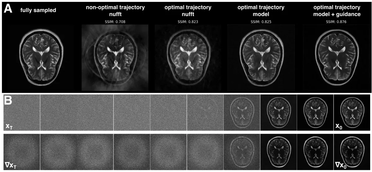 (A) Effect of sampling trajectory optimization, model reconstruction without frequency guidance, and model reconstruction with frequency guidance. For the non-optimized trajectory, we used a single interleave Archimedean spiral with a readout duration of 0.02 s. The optimized trajectory uses a 23 interleave, α = 1.23 sequence with an identical readout duration. (B) Snapshots of the image latent x<sub>t</sub> and the gradient signal ∇x<sub>t</sub> taken during a diffusion sampling process.