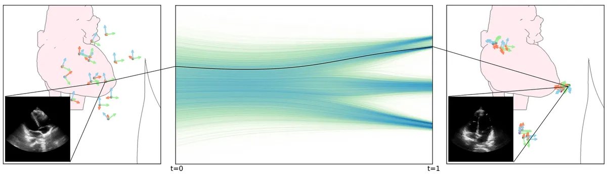 TTE image acquisition can be viewed as a distribution transport problem, where samples from the distribution of random probe placements are transformed into optimal probe placements corresponding to specific canonical views.