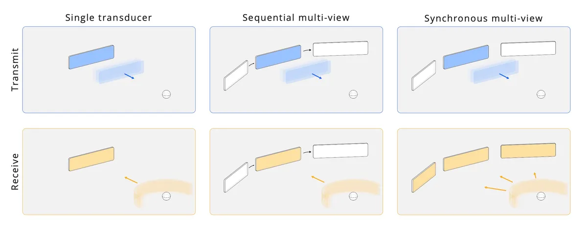Typical diagnostic ultrasound imaging uses a single transducer to both transmit a pulse and receive back-scattered signal. Multi-view ultrasound involves the collection and aggregation of more information into a single image. Data collection can be sequential, involving a series of single transducer images, or it can be synchronous, where multiple transducers transmit and/or receive simultaneously.