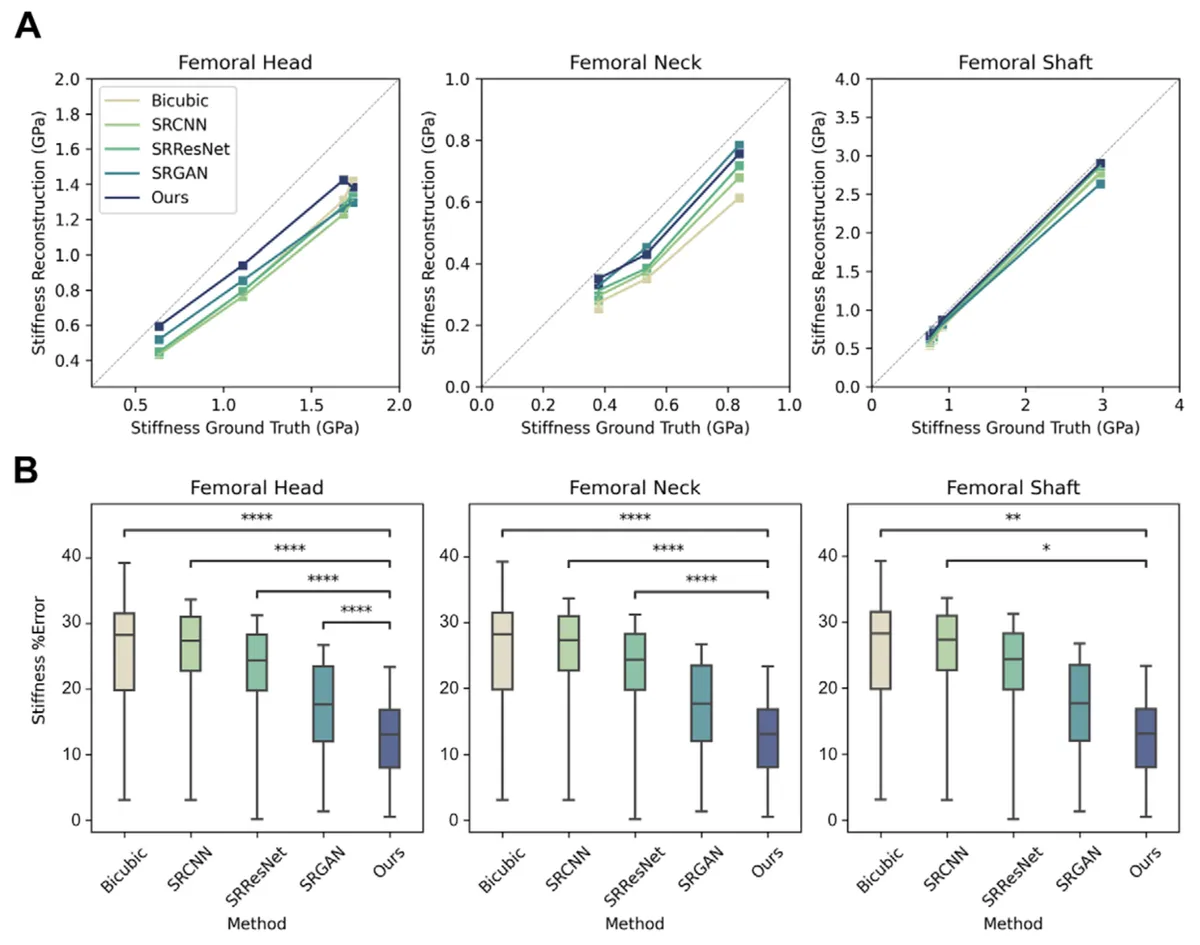 Mechanical stiffness, calculated by finite element analysis, was compared across five reconstruction methods. There were 32 regions of interest analyzed in femoral heads, 16 in femoral necks, and 16 in femoral shafts. (A) Reconstruction is plotted against ground truth, with the gray line denoting perfect agreement. (B) The corresponding percentage errors are plotted with statistical significance determined by a Friedman test and post hoc Dunnett test, with Bonferroni correction for multiple comparisons. Top and bottom edges of boxes indicate dataset quartiles, horizontal lines the means of the datasets, and whiskers the full range. * = P ≤ .05, ** = P ≤ .01, **** = P ≤ .0001. BV/TV = bone volume over total volume, SRCNN = super-resolution convolutional neural network, SRGAN = super-resolution generative adversarial network, SRResNet = super-resolution ResNet, TbN = trabecular number, TbSp = trabecular spacing, TbTh = trabecular thickness.